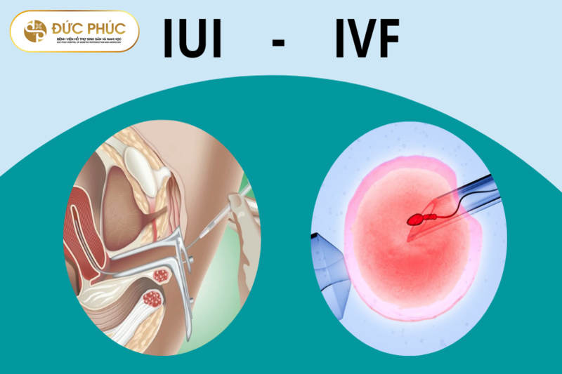 Sự khác biệt giữa IVF và IUI
