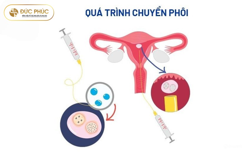 Chuyển phôi