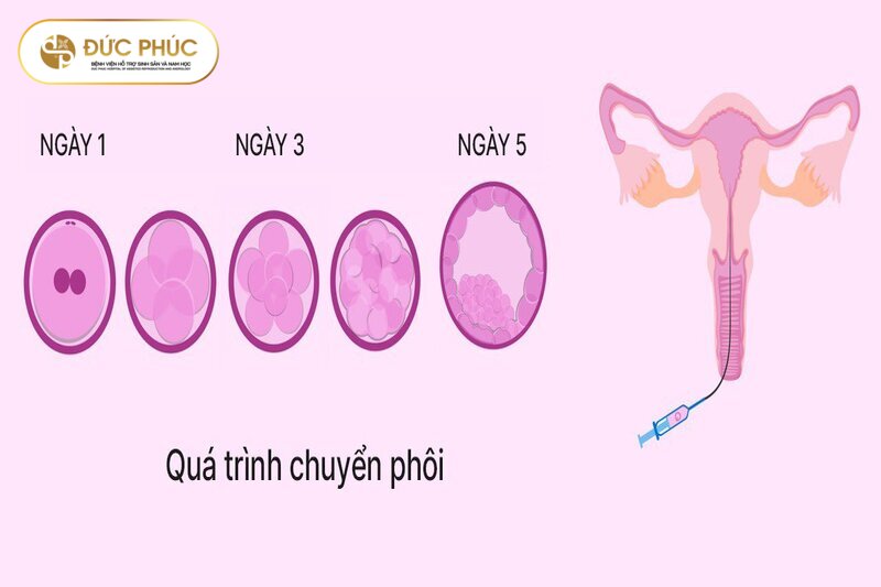 Thời gian thực hiện IVF