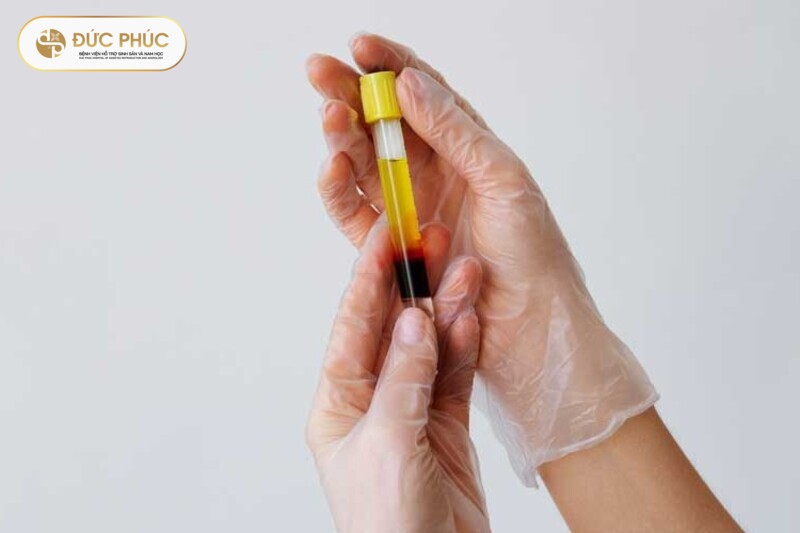 Phương pháp tiêm huyết tương giàu tiểu cầu tự thân (PRP) cho IVF